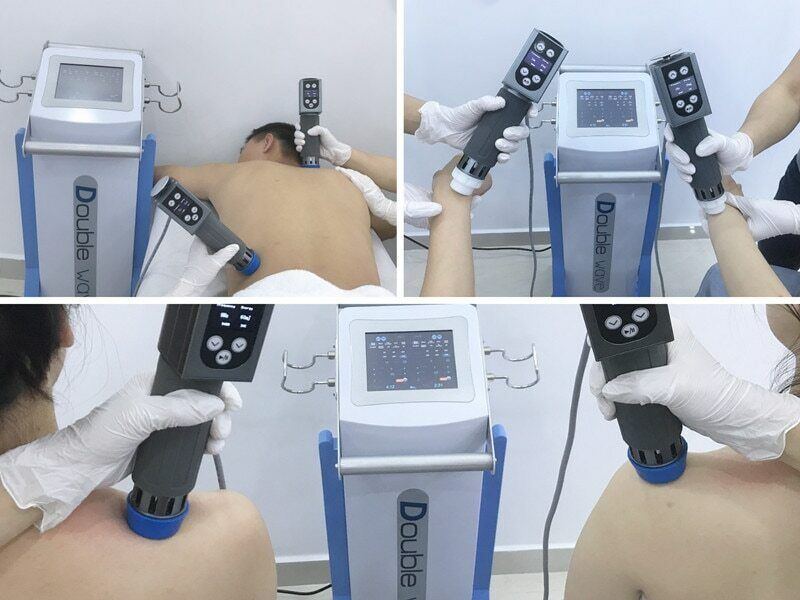 Extracorporeal Shockwave Therapy