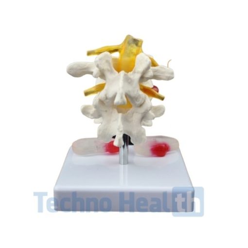 Lumbar intervertebral Spine Model