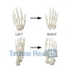 Anatomical Bone models for orthopaedic