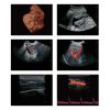 Sonoscape S12 3D 4D Color Doppler