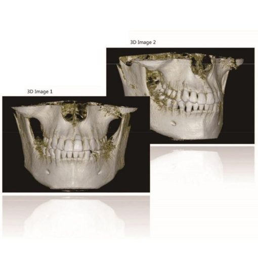 H-X9010D Pro 2D CBCT Digital Panoramic Dental X-ray Scan Machine