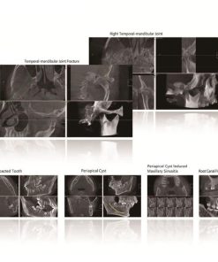 H-X9010D Pro 2D CBCT Digital Panoramic Dental X-ray Scan Machine