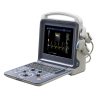 Healicom THUC-300 Portable 4D Color Doppler Ultrasound Scanner