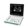 latest ultrasonography machine price in bd