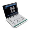 Mini Ultrasound Machine Price in BD