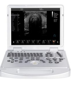 4d Ultrasonography Machine Price in Bangladesh