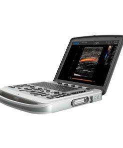 Chison SonoBook 6 Ultrasonography Machine