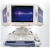 Toshiba Ultrasound Machine