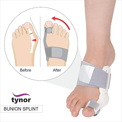 Tynor Bunion Splint K-14 Price in Bangladesh