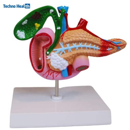 Human Anatomy Model of the Pancreas, Duodenum, and Gallbladder Price in BD