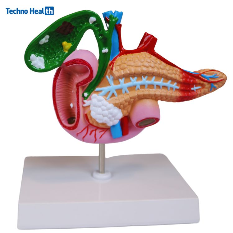 Human Anatomy Model of the Pancreas, Duodenum, And Gallbladder
