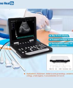 Application of Karestar K-H300 Digital Portable BW Ultrasonography Machine
