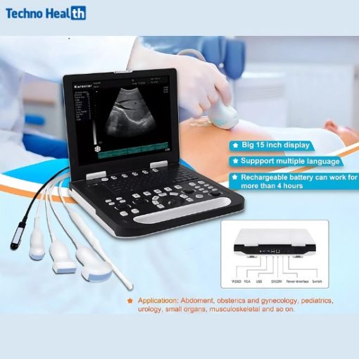 Application of Karestar K-H300 Digital Portable BW Ultrasonography Machine