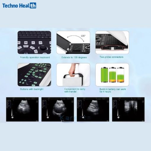 Karestar K-H300 Digital Portable B/W Ultrasonography Machine - Image 2