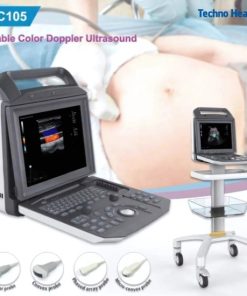 Features of Karestar K-C105 Digital Color Ultrasound Machine