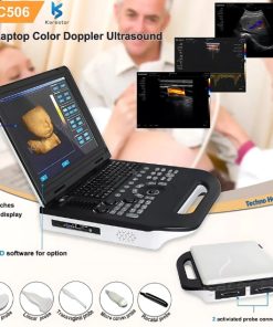 Features of Karestar K-C506 Ultrasound Scanner