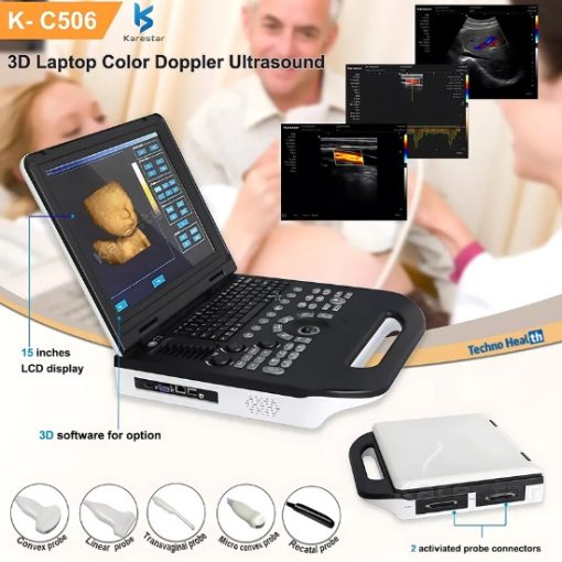 Features of Karestar K-C506 Ultrasound Scanner