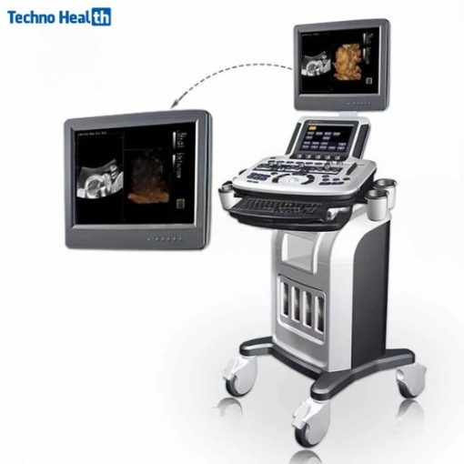 Karestar K-AU6 Ultrasonography Machine (Trolley)