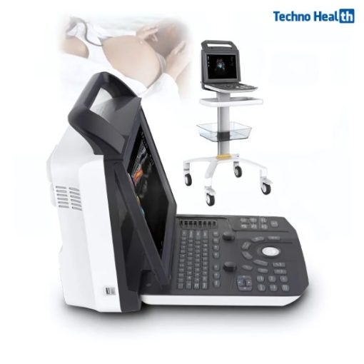 Karestar K-C105 Digital Color Ultrasound Machine