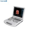 Karestar K-C300 Portable Ultrasound Machine