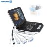 Karestar K-C506 3D 4D Portable Ultrasound Scanner