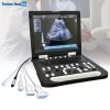 Karestar K-H300 Digital Portable BW Ultrasonography Machine