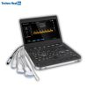 Karestar K‑H101W Digital Portable MSK Ultrasound Scanner