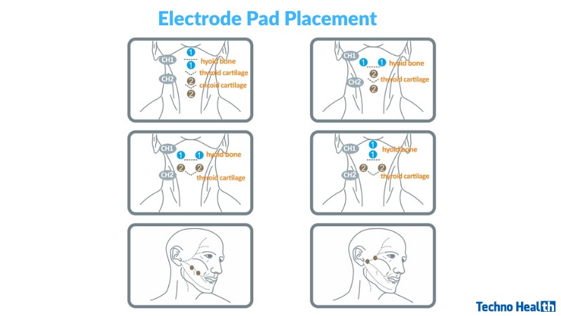 Electrode Pad Placement