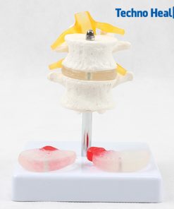 Lumbar intervertebral Spine Model