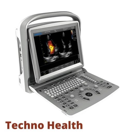 Chison ECO 6 Ultrasound