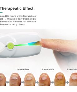 Toenail Laser Therapy | Nail fungus treatment machine | Take care of your nail at home 7 Toenail laser therapy 2 1