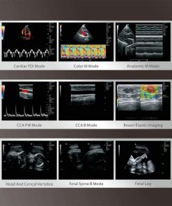 Healicom THUC-950 Trolley 4D Color Doppler Ultrasound Scanner 9 Healicom THUC-950 Trolley 4D Color Doppler Ultrasound Scanner