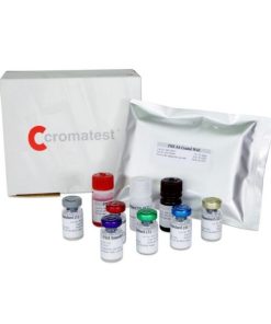 TSH Test Price in Bangladesh