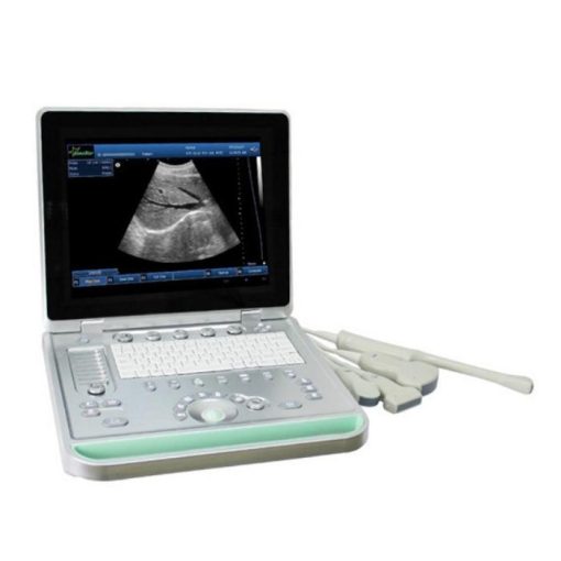 Mini Ultrasound Machine Price in BD