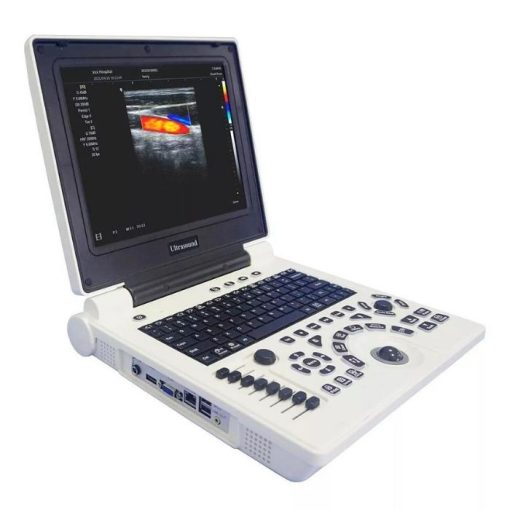 Ultrasonography Machine Price in BD