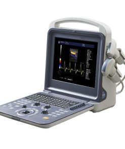 Healicom THUC-300 Portable 4D Color Doppler Ultrasound Scanner 7 Healicom THUC-300 Portable 4D Color Doppler Ultrasound Scanner