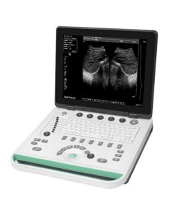 latest ultrasonography machine price in bd