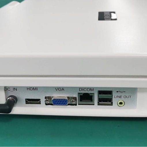 Ultrasonography Machine Price in BD
