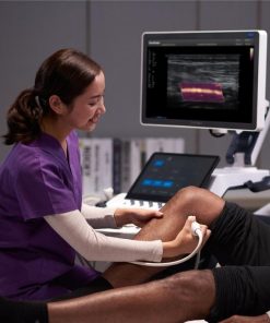 Sonoscape S60 Mobile 3D/4D Color Doppler Ultrasound Machine 7 Sonoscape S60 Mobile 3D/4D Color Doppler Ultrasound Machine