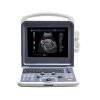 Healicom THUC-300 Portable 4D Color Doppler Ultrasound Scanner 8 Healicom THUC-300 Portable 4D Color Doppler Ultrasound Scanner