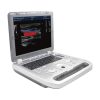 Healicom THUC-550 Color Doppler Ultrasonic Diagnostic Device 10 Healicom THUC-550 Color Doppler Ultrasonic Diagnostic Device