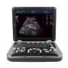 Healicom THUC-570 Color Doppler Ultrasonic Diagnostic Device 6 HUC-570 Color Doppler Ultrasonic Diagnostic Device