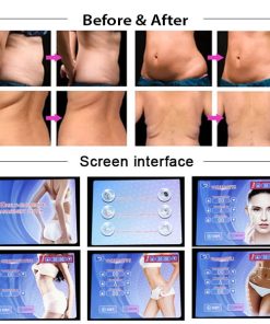 RF Cavitation Weight loss machine 6 Weight loss machine price in Bangladesh