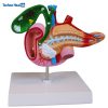 Human Anatomy Model of the Pancreas, Duodenum, and Gallbladder 10 Human Anatomy Model of the Pancreas, Duodenum, and Gallbladder Price in BD