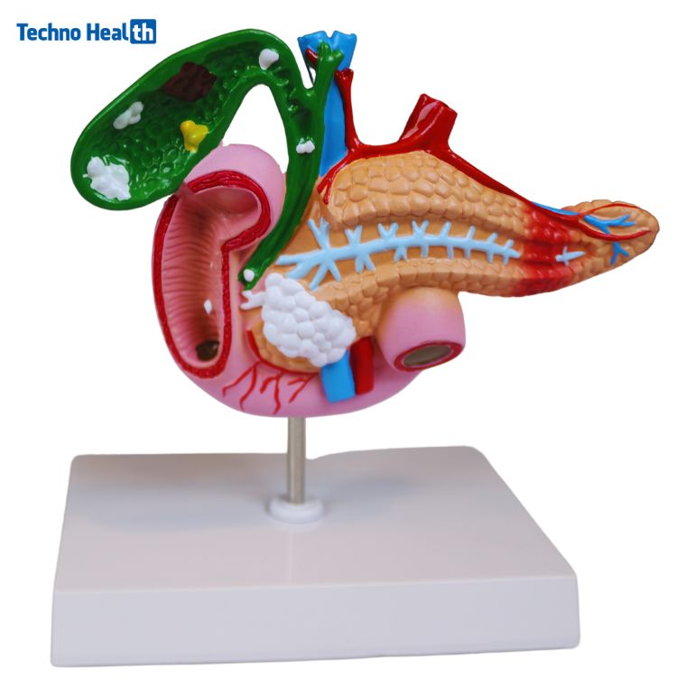 Human Anatomy Model of the Pancreas, Duodenum, and Gallbladder 1 Human Anatomy Model of the Pancreas, Duodenum, and Gallbladder Price in BD