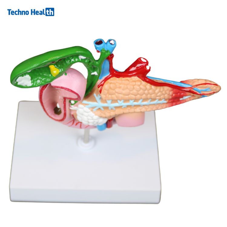 Human Anatomy Model of the Pancreas, Duodenum, and Gallbladder 2 Pathological Anatomy Model of the Pancreas, Duodenum And Gallbladder