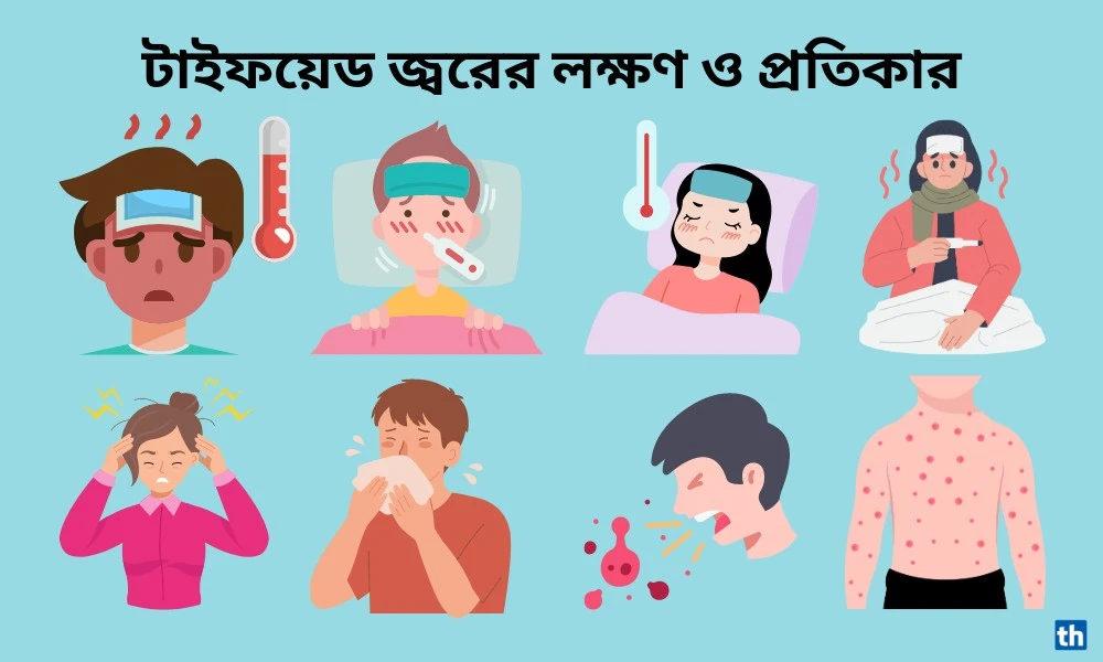 টাইফয়েড জ্বরের লক্ষণ ও প্রতিকার 3 টাইফয়েড জ্বরের লক্ষণ ও প্রতিকার