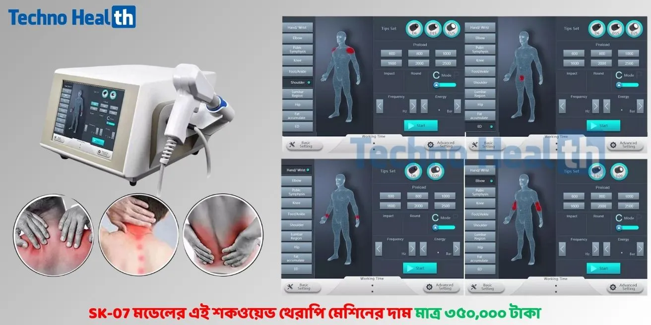 শকওয়েভ থেরাপি মেশিনের দাম কত