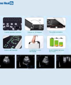 Karestar K-H300 Digital Portable B/W Ultrasonography Machine 4 Feature of Karestar K H300 Digital Ultrasonography Machine