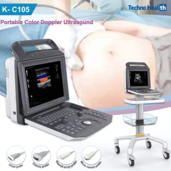 Karestar K-C105 Digital Color Ultrasound Machine 3 Features of Karestar K-C105 Digital Color Ultrasound Machine